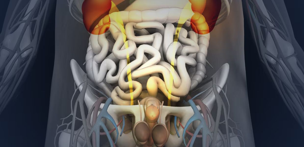 Congenital Genito-Urinary abnormality