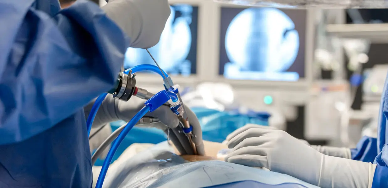 Spine Treatment in India for Kenya Patients
