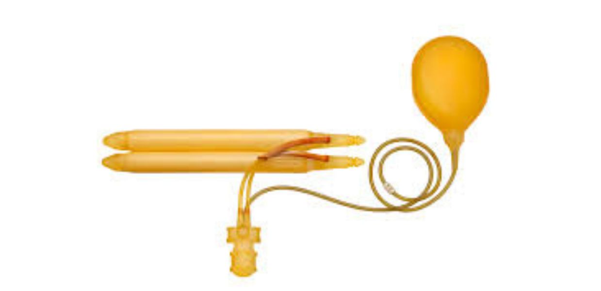 All about Penile Implants and more