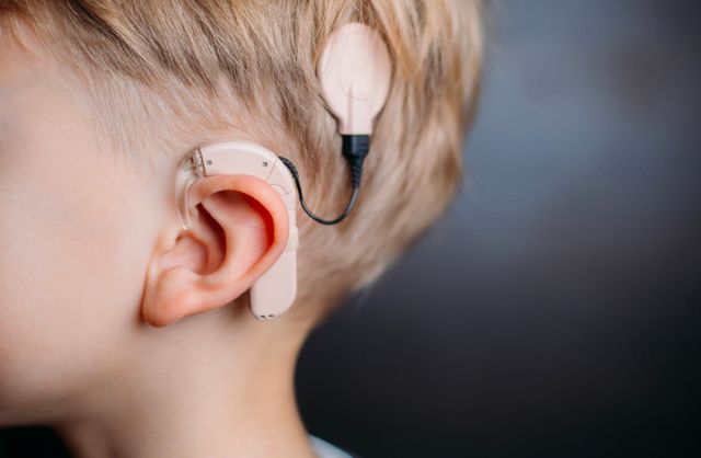 Cochlear Implant Surgery in India | Cost, Best Hospitals & Specialists