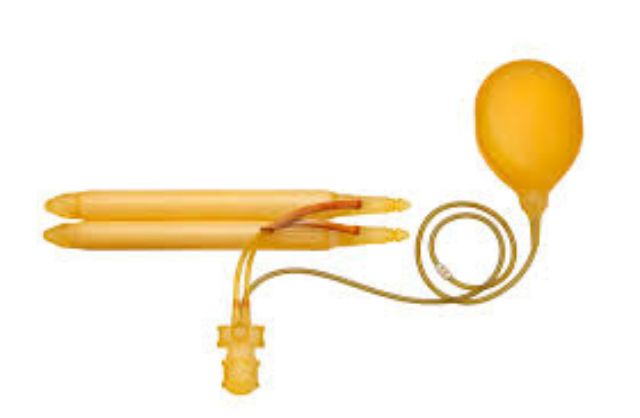 All about Penile Implants and more
