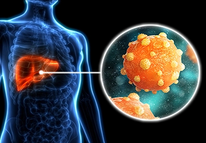 chronic testicular pain