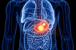 Thyroid Surgery
