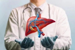 Liver Transplant
