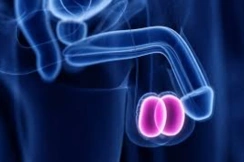 chronic testicular pain