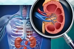 nephrectomy