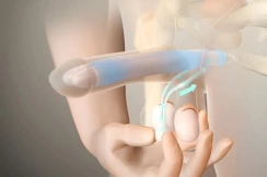 penile implant