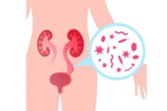 Urinary Tract Infection